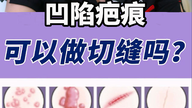 凹陷疤痕可以做切縫嗎？謝寶花：當然可以！