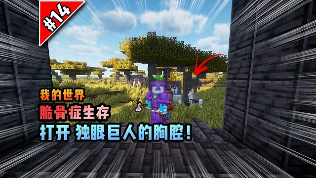脆骨癥第十四集：打開獨眼巨人的胸腔！