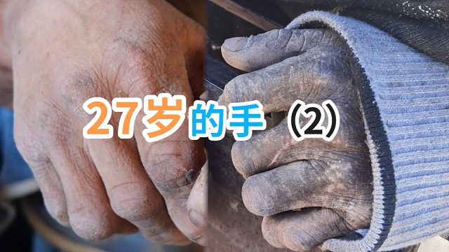 一双记不得多久没洗过的手。如果是你，你愿意为他洗手洗脚吗？