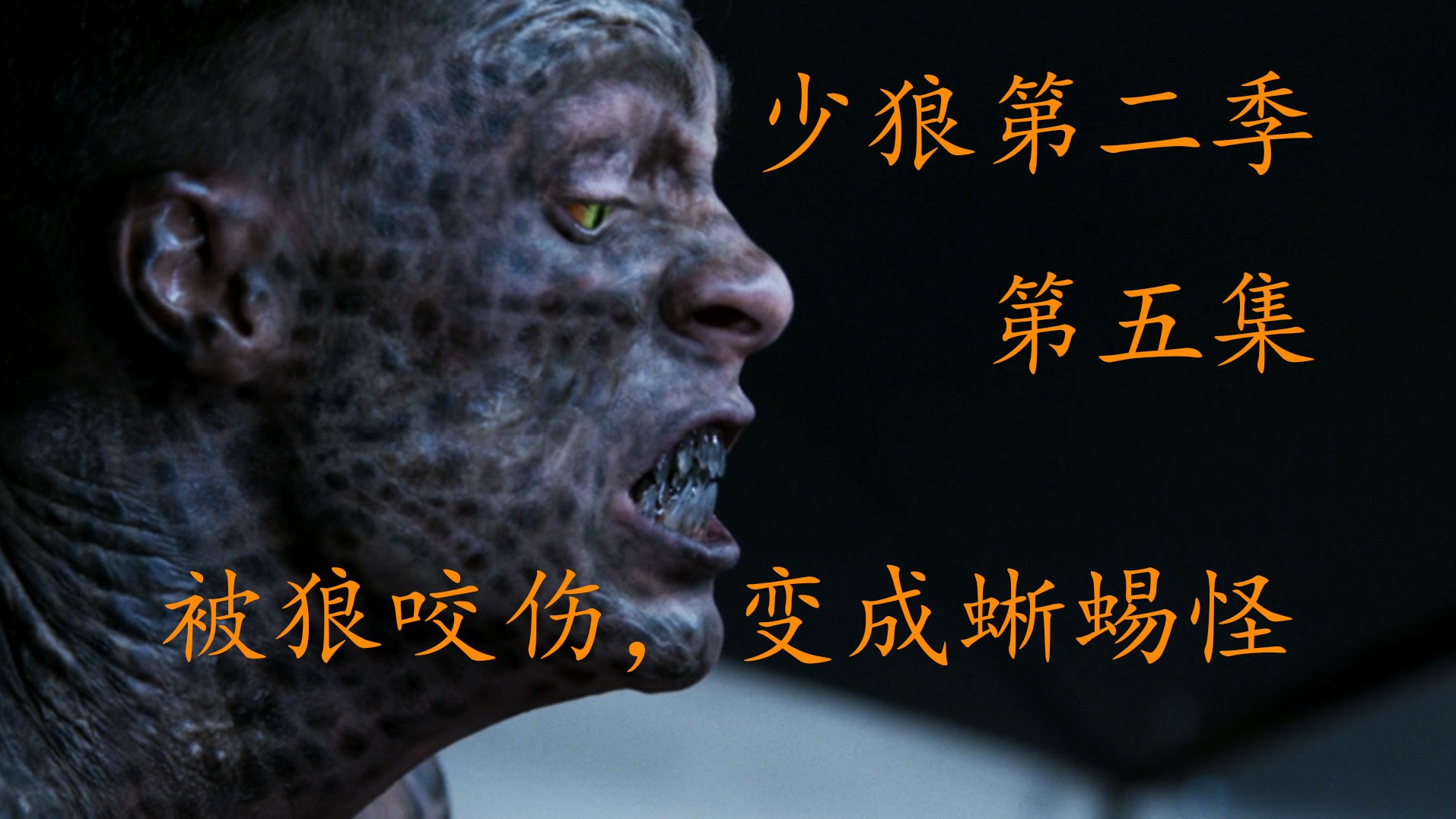 医院设备都检查不出原因，竟然是野外泡澡患上的病