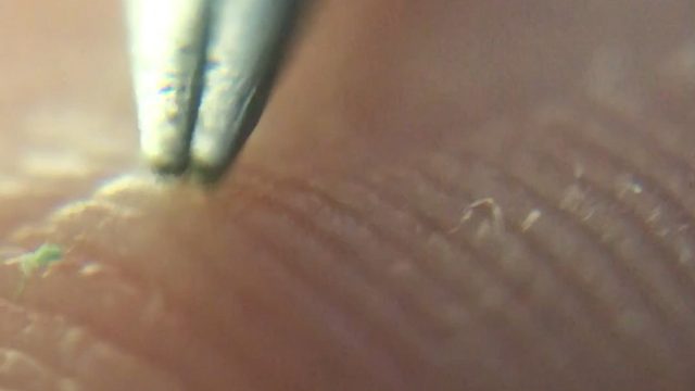 拔一根非常非常非常小的刺