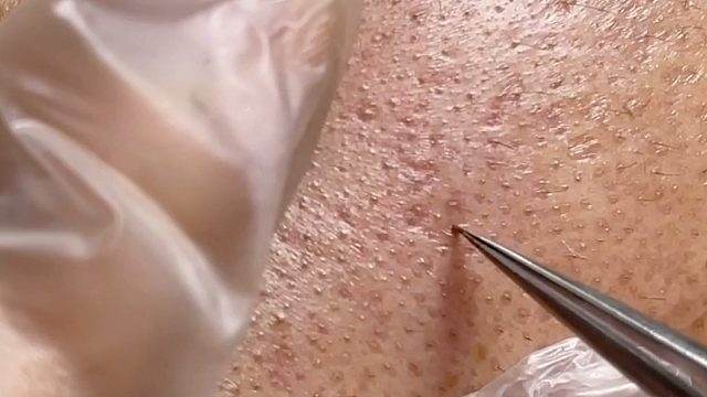 年龄不决定一切容颜才是硬伤！