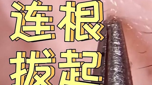 日常下饭视频：黑头清洁，连根拔起！