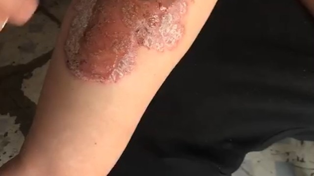 这个不是事。没有忌口。