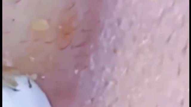 一戳全爆出来那一刻，简直不要太舒爽