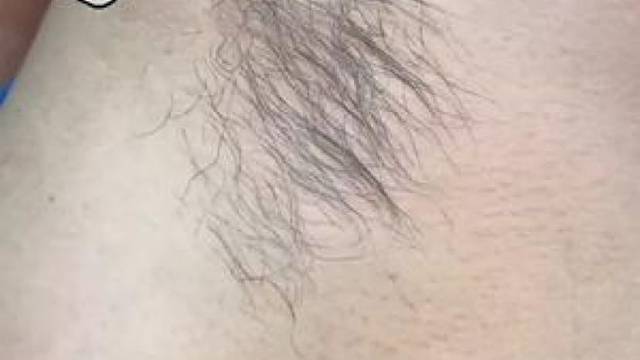 夏天来了，毛要来脱了