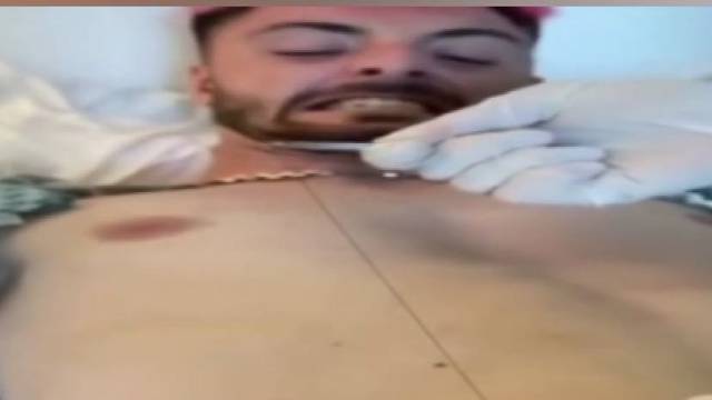 祛除内生毛，看完直接爽到原地起飞