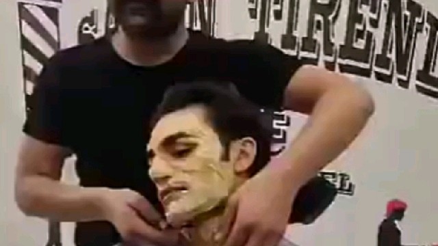 黑头和头发都粘了下来？？