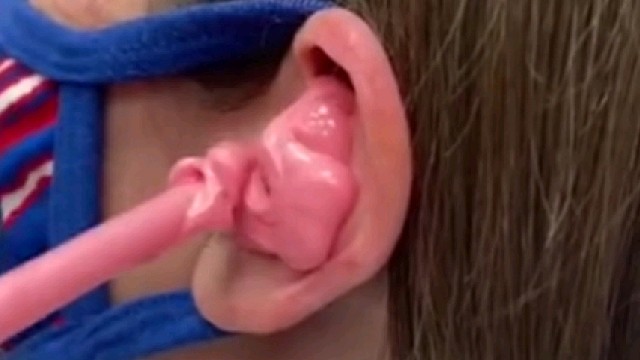 现在掏耳屎成本这么高吗？