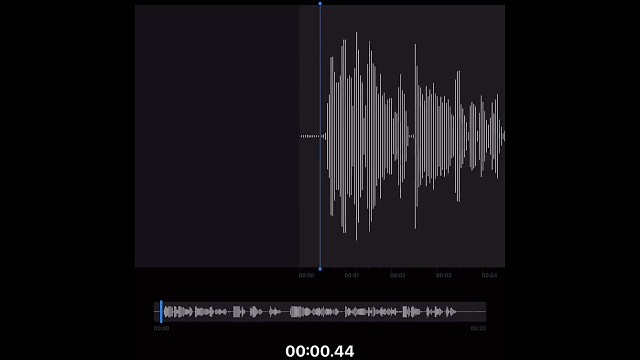 最好的心理医生是有一位耐心的爱人