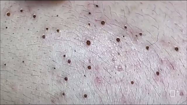 强迫症福利，密集恐惧症患者慎入！