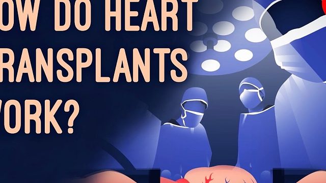心脏移植手术是如何实施的？