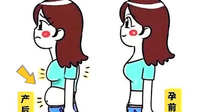 三招帮你搞定盆骨前倾