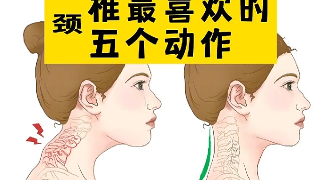 颈椎最喜欢的五个动作！分享给身边颈椎不好的人吧！