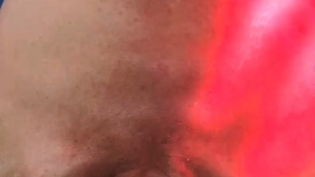 有皮肤问题问我