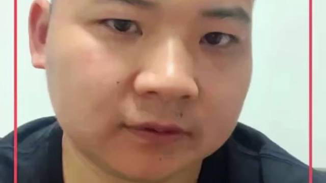 嘴角的痣