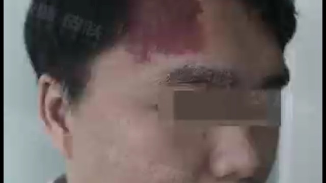 红色的印记带来的更多的是创伤