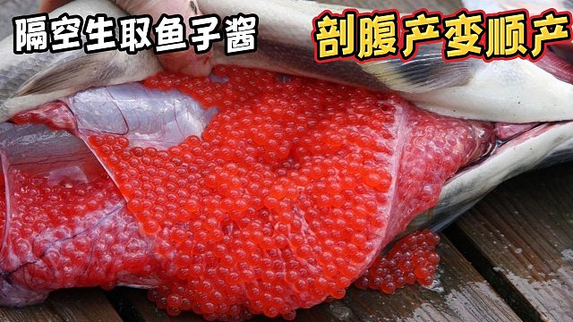 “隔空”就可活取鱼子酱？剖腹产直接变无痛分娩