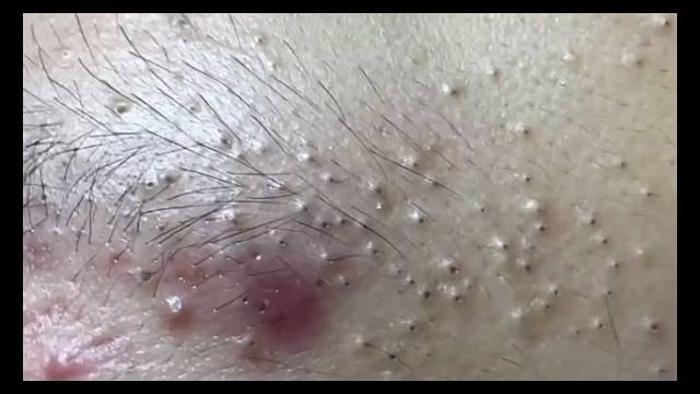 密密麻麻麻麻赖赖