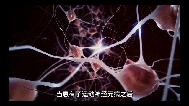 运动神经元病没及时治疗会怎么样？