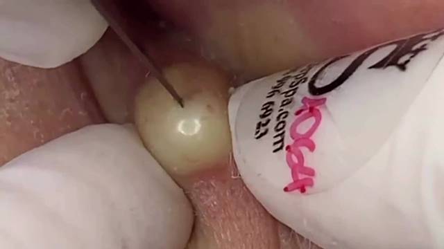 敢相信这是耳背？