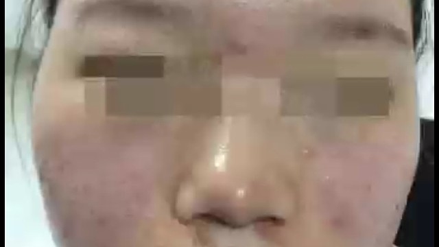 本该美丽的女子缺遭受皮肤病的困扰