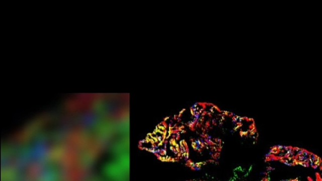 遗传工程法可以延长寿命？