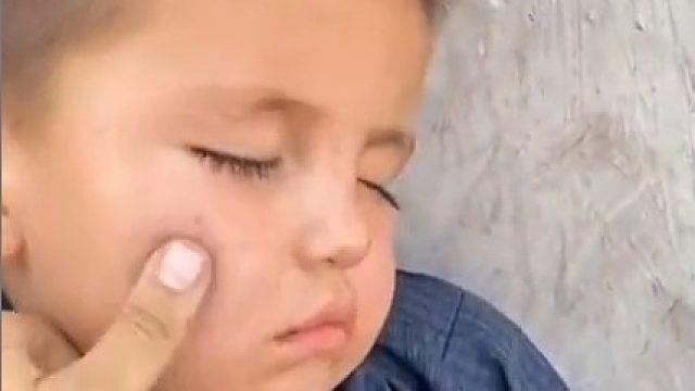 看着这个视频我哭了，没有人应该生来就遭受这样的苦难