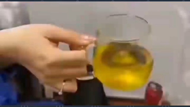 特发性震颤典型症状