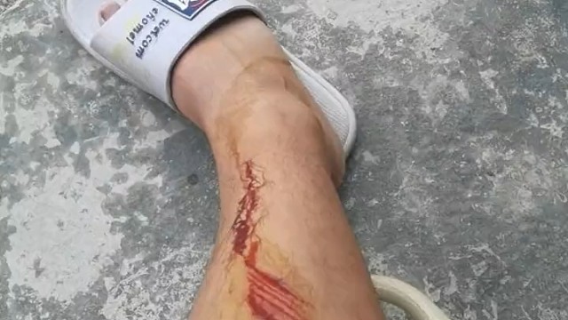 这个一点都不痛！！！