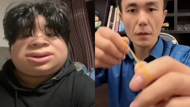 呱唧菌