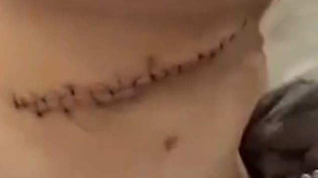 丈夫自觉无法挽回妻子的心，用水果刀割妻子颈部