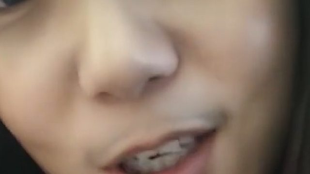 女子称阳后发烧长出胡子，烧退了胡子没退，在线求科普：这是什么情况