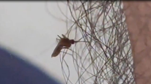 论腿毛的重要性