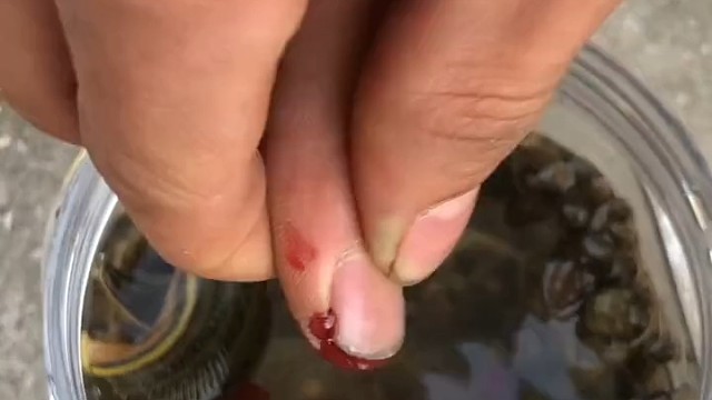 隔这和水蛭滴血认亲呢[xiaochou]