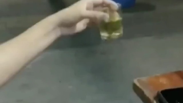 经常处于紧张激动的状态，对特发性正常的恢复非常不利，因此患者要注意做好心理调节，正确的认识疾病，不要