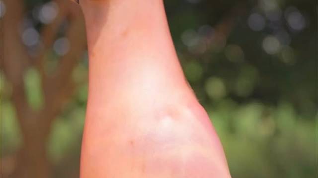 油淋脆皮嘎嘎香