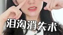 长沙艺星-双美胶原蛋白填充泪沟效果好吗？#NBS气质微整#艺星整形靠谱吗#艺星整形怎么样