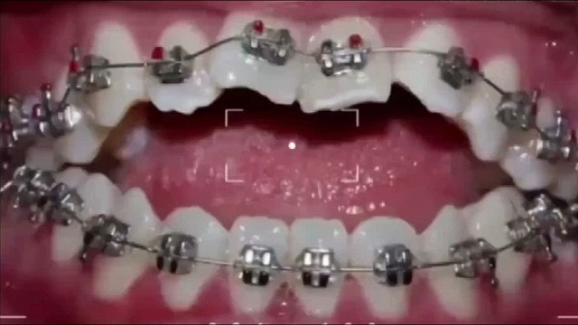 记录你一点一点变美的过程