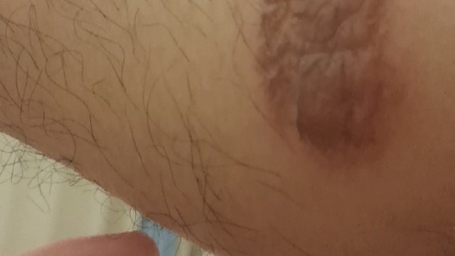 挤什么豆豆挤这个更爽