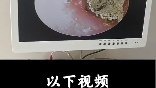 清理洞洞