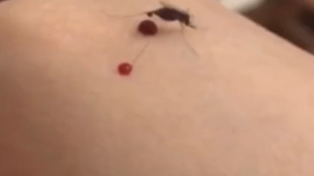 自动吸血抽血功能！