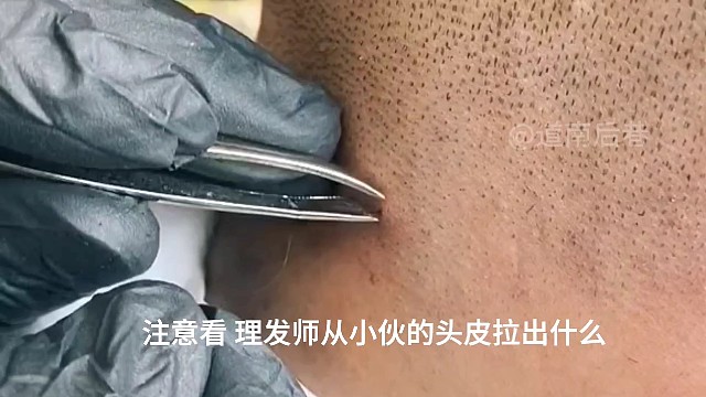 国外小伙头发长肉里，理发师拯救