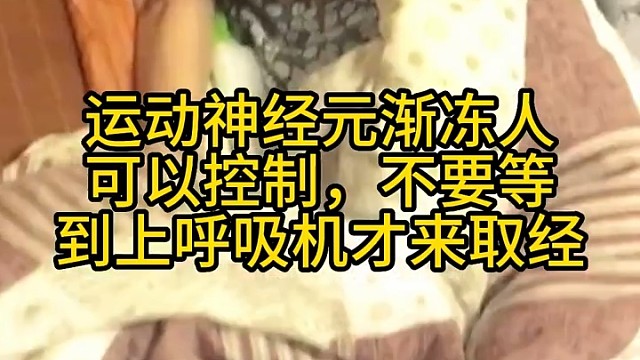 运动神经元病早期症状不明显，导致很多人没有察觉到患病。症状通常缓慢加重，但不同类型患者的症状和疾病发