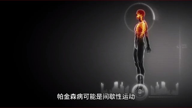 帕金森是偶尔抖还是经常抖