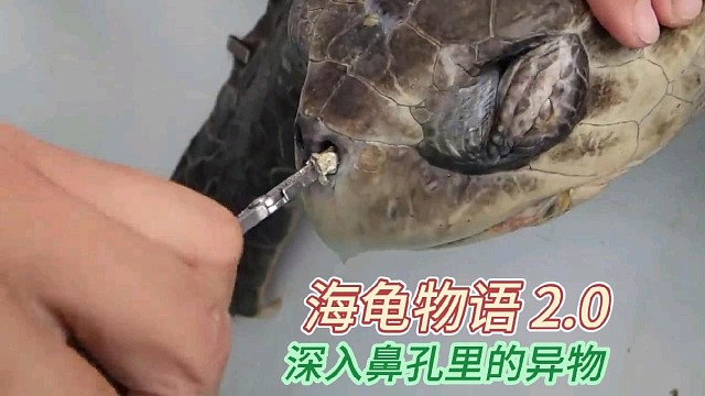 好难受啊，鼻孔里有异物