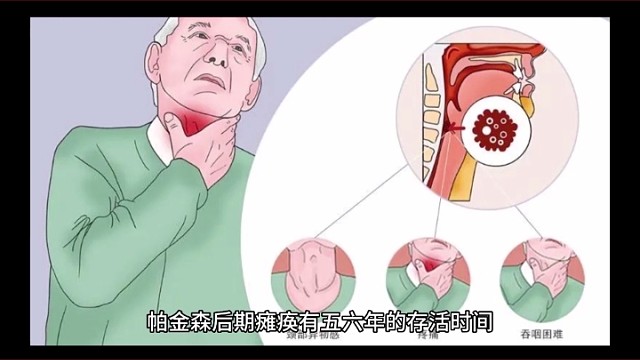 帕金森后期瘫痪还能活多久？