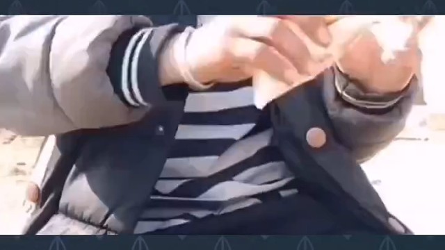 一般情况下，该病引起的震颤具有一定的对称性，若是未能及时给予控制，震颤幅度会逐渐加大，继而影响日常生