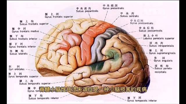 中医治疗小脑萎缩走路不稳