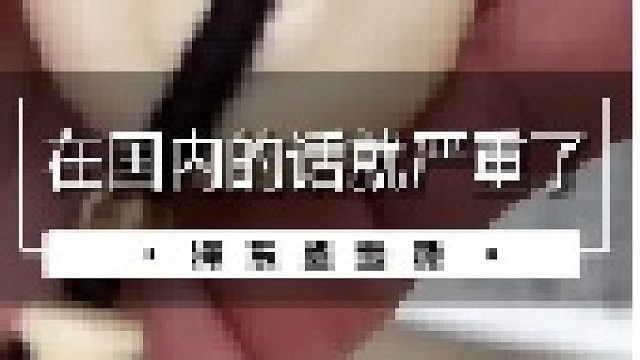 在国内的话就严重了